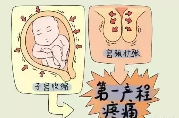 产妇准备:宫颈从0开到3指,速度比较慢,这个阶段孕妇可以吃一点食物