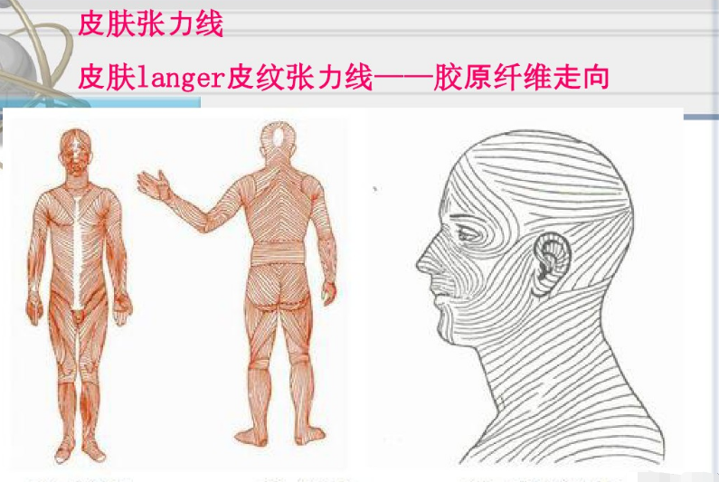 "皮肤张力是影响疤痕大小的重要因素.
