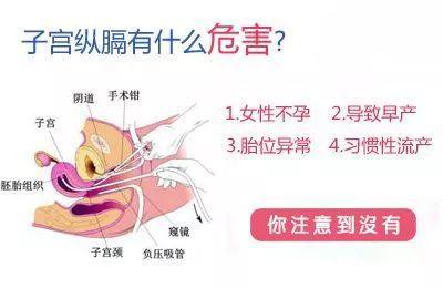 子宫里长出"一堵墙",这是咋啦