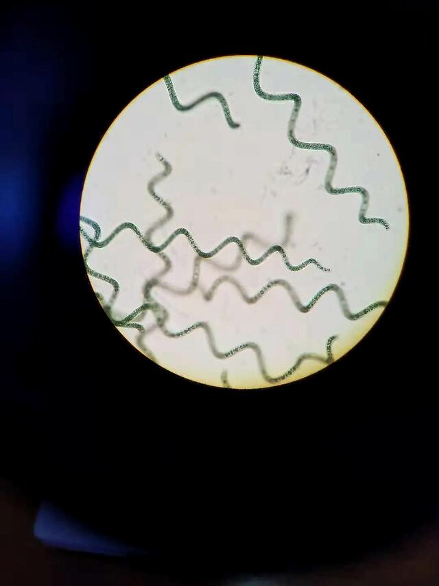 显微镜下的螺旋藻