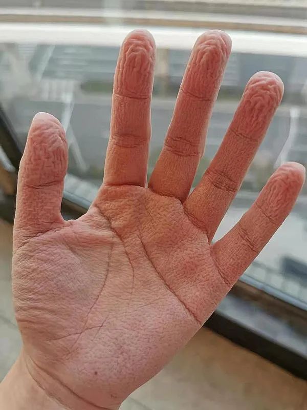 白衣天使的手,看了让人泪目