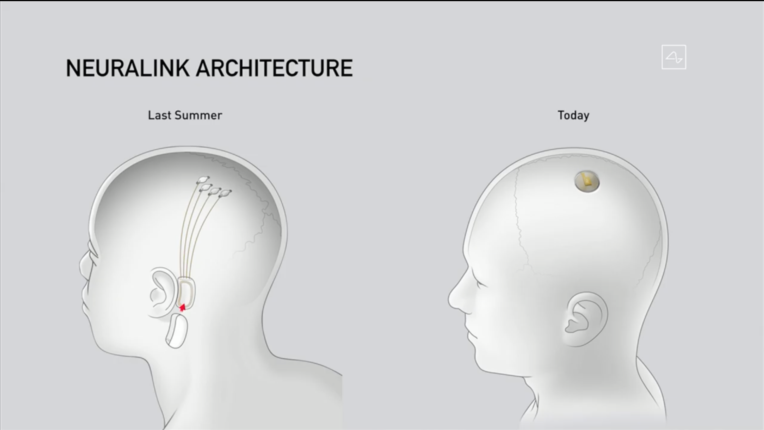 马斯克展示脑机接口硬币大小芯片植入猪脑实时读取猪脑信息