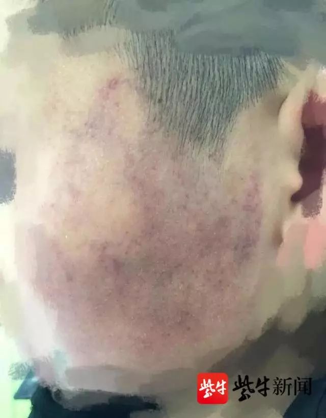 老师殴打学生被调离，几十名家长联名求情