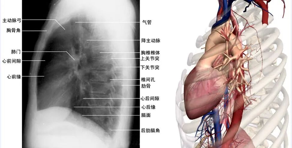 "绿宝书"丨不同体位拍摄的心脏胸片影像