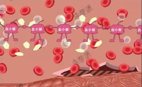 因血小板减少而发生出血的现象在血液科很常见,因为血小板在血液中