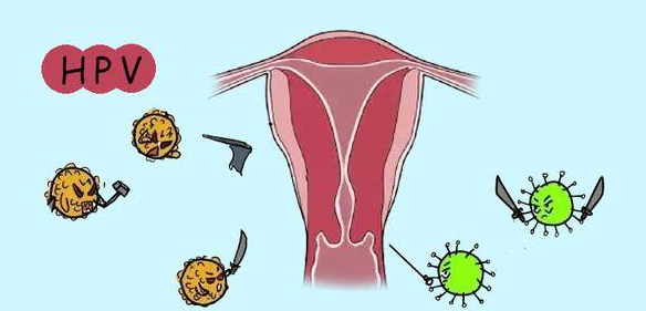具体来说, hpv病毒在女性中间是分两大类的,一类是宫颈癌问题,一类则