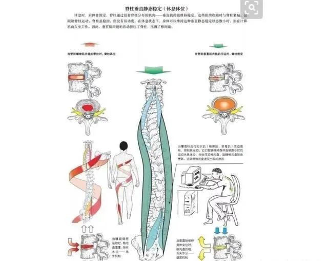 螺旋链训练,也有助于矫正脊柱侧弯.