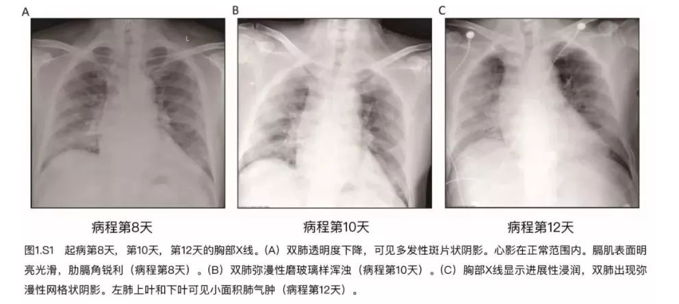 首例新冠肺炎病理解剖