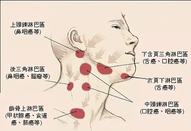 颈部淋巴,比较集中的部位分别是耳前耳后,腮边,下颌,颈身,后颈等.