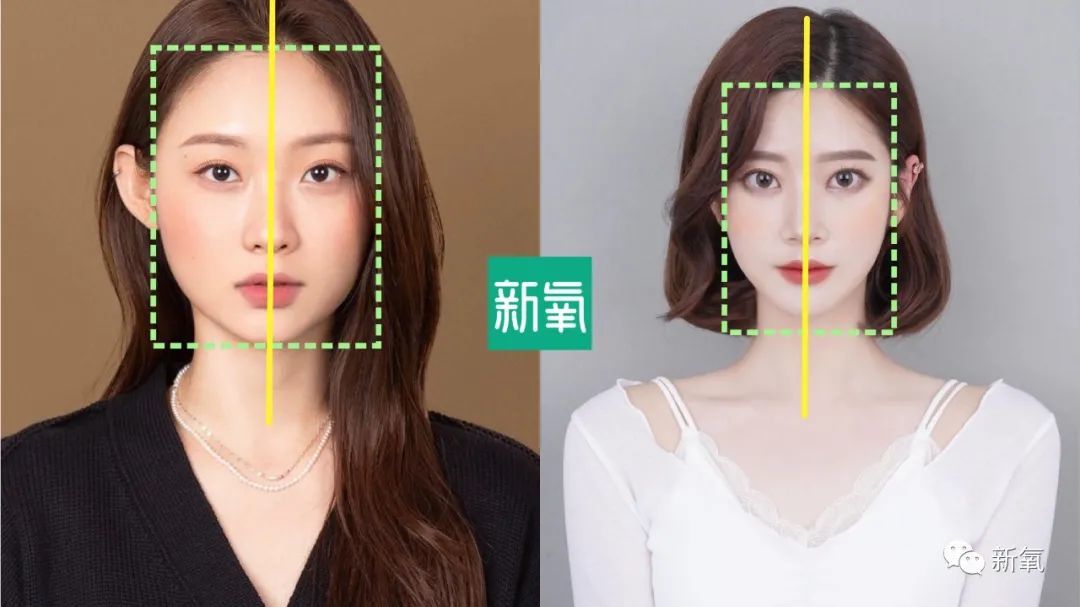 如何改善歪脸先说情况最严重的「不对称」是天生下颌骨的歪斜,上下颌