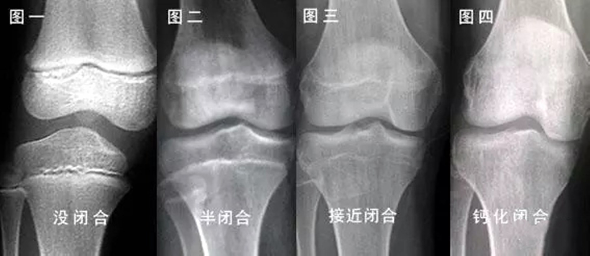 抓住孩子长个最后期限,提前做好准备,还能多长高几厘米