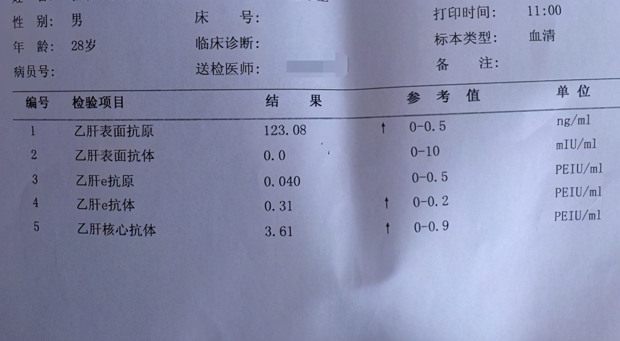 乙肝五项怎么看,手把手教学,学会了,你就是半个医生