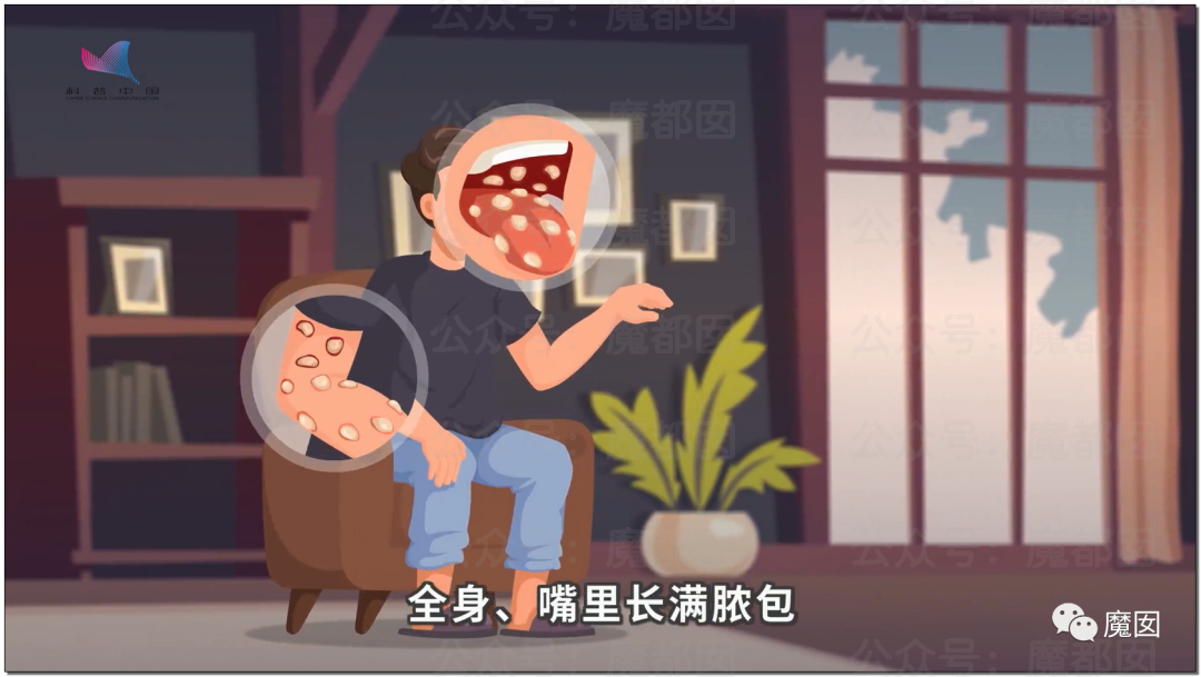广东夫妇在饭店吃到带血胶布一查厨师有梅毒