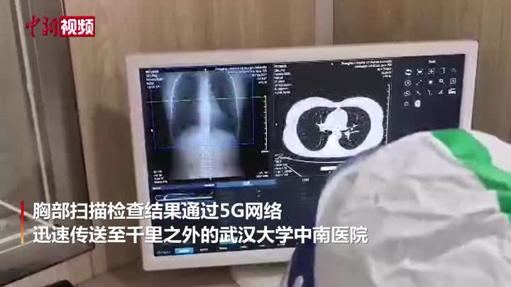 半小时形成检查报告!湖北援冀移动ct正式开始工作