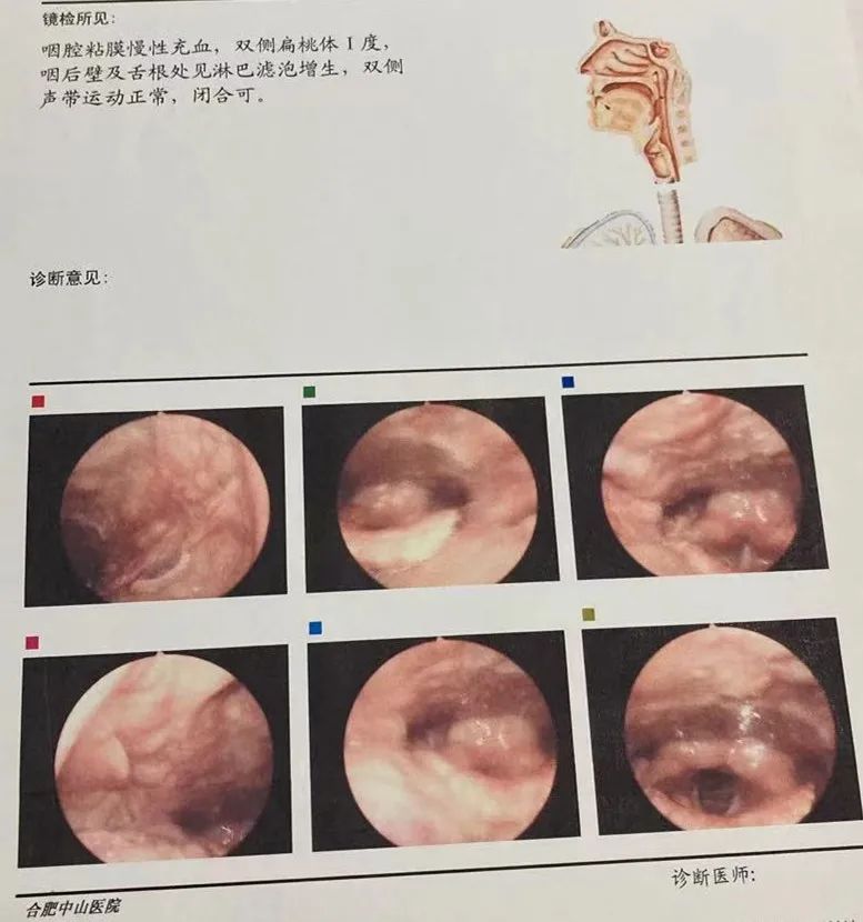 被诊断为甲状腺囊肿