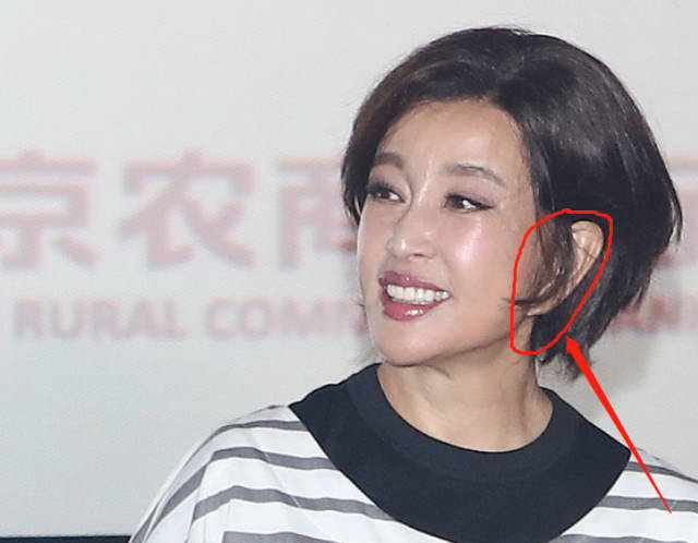 刘晓庆"过度拉皮"背后:富人对衰老有多恐惧?