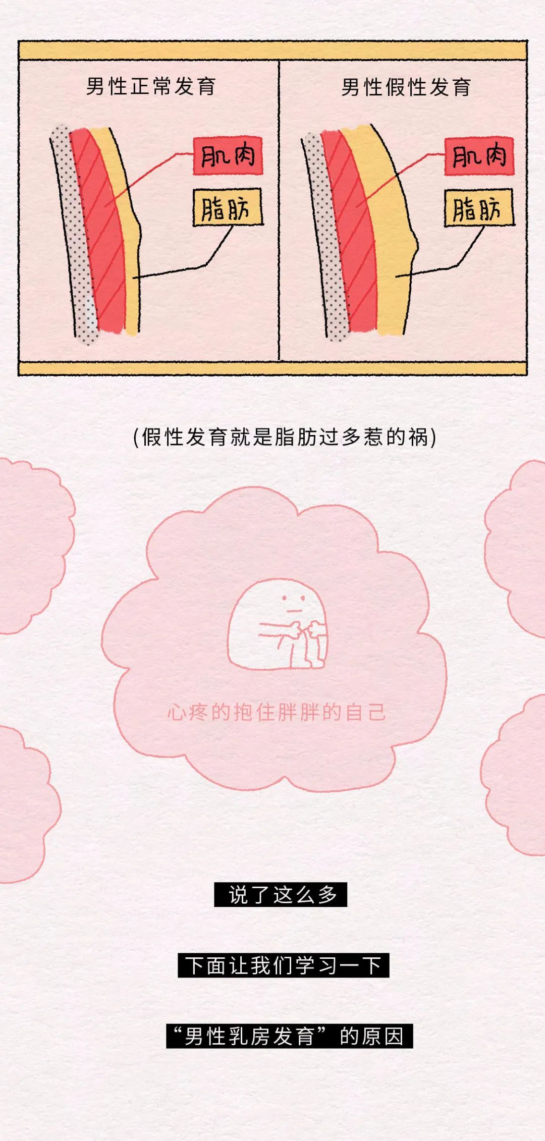 为什么男性乳房会发育?