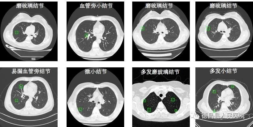 早治疗促进委员会"(简称"癌促委"),下辖消化道肿瘤,肺癌,乳腺癌,妇科