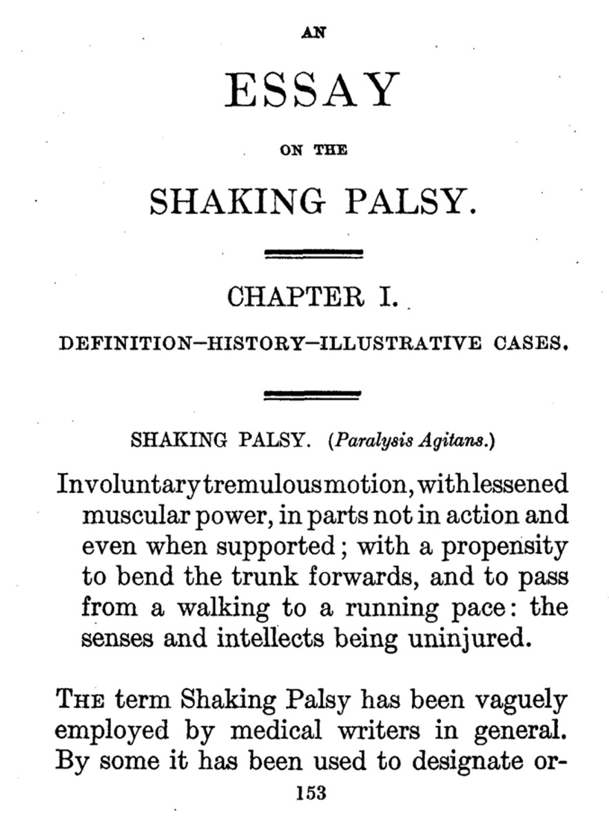 他在题为《论震颤性麻痹(an essay on the shaking palsy)的专著中