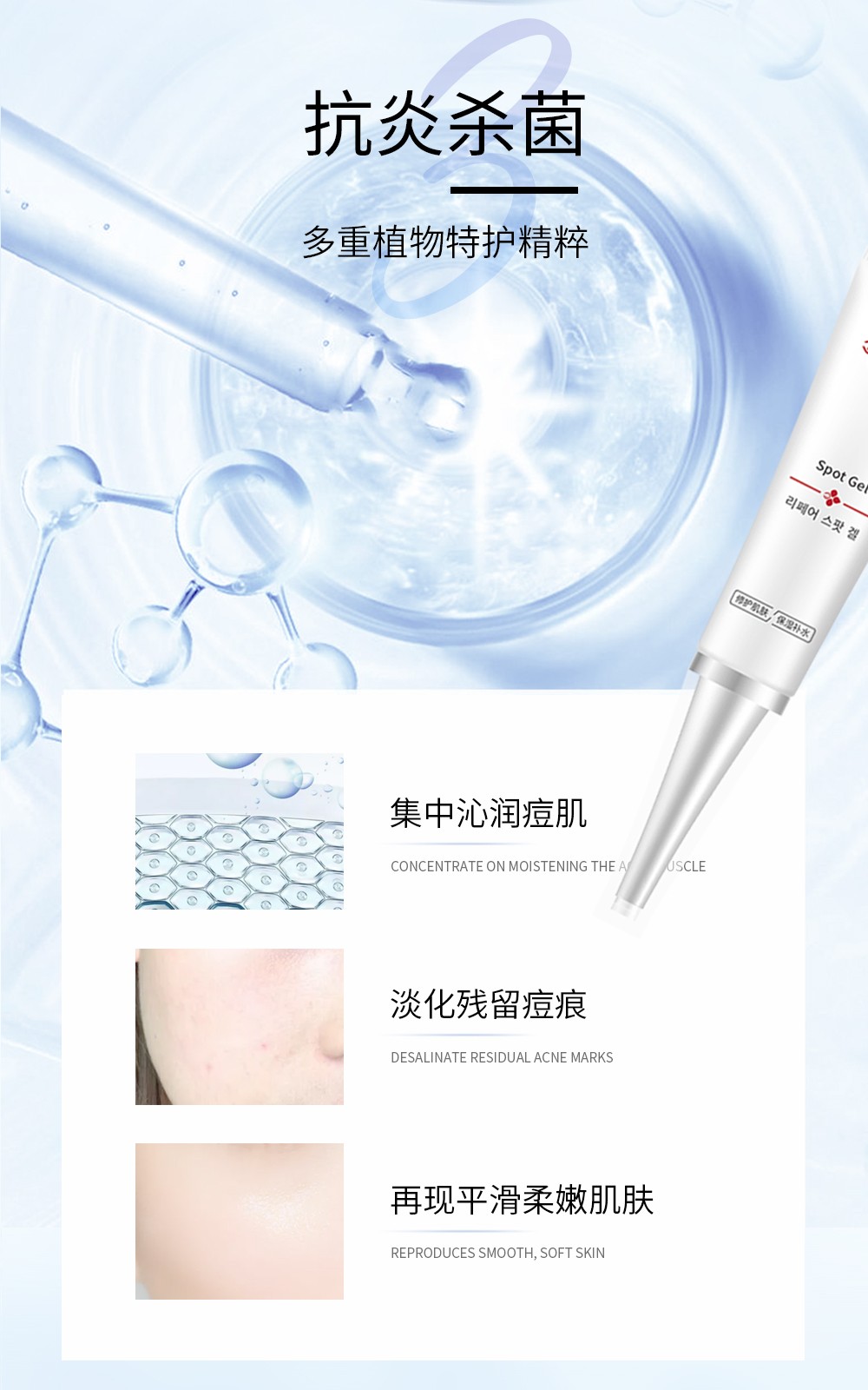 痘痘克星诗臻泊旗下诗研佳修护点涂凝胶为你摆脱痘肌烦恼