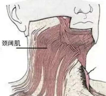 正常的颈阔肌,很紧致,它的的张力,形状,有支撑脂肪组织的能力,在颈部