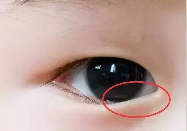 孩子频繁眨眼睛,家长别不当回事,小心孩子的健康受到"威胁"