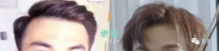 再加上妆容的加持,"头包脸"的帅哥氛围就这样营造出来了.