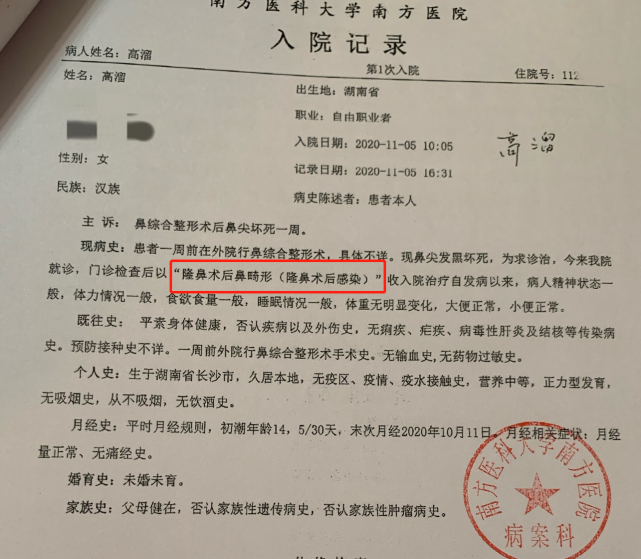 在广州南方医院的入院记录显示:该医院门诊检查后,以"隆鼻术后鼻畸形