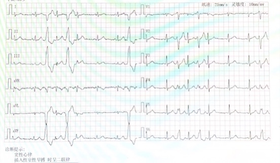 孕产妇入院时的心电图报告.本文图片均为上海新华医院 供图