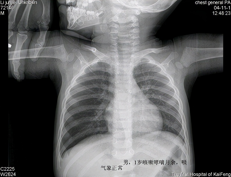 因支持视频回放,连续点片两大功能,更能保证医师的检查效率及诊断正确
