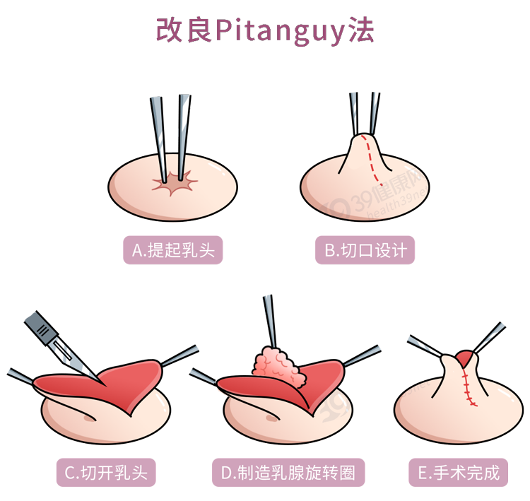 这群没有乳头的人是怎么回事