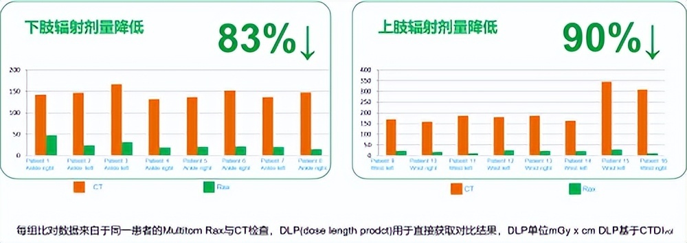 悬吊动态x光机华而不实价超ct难以普及