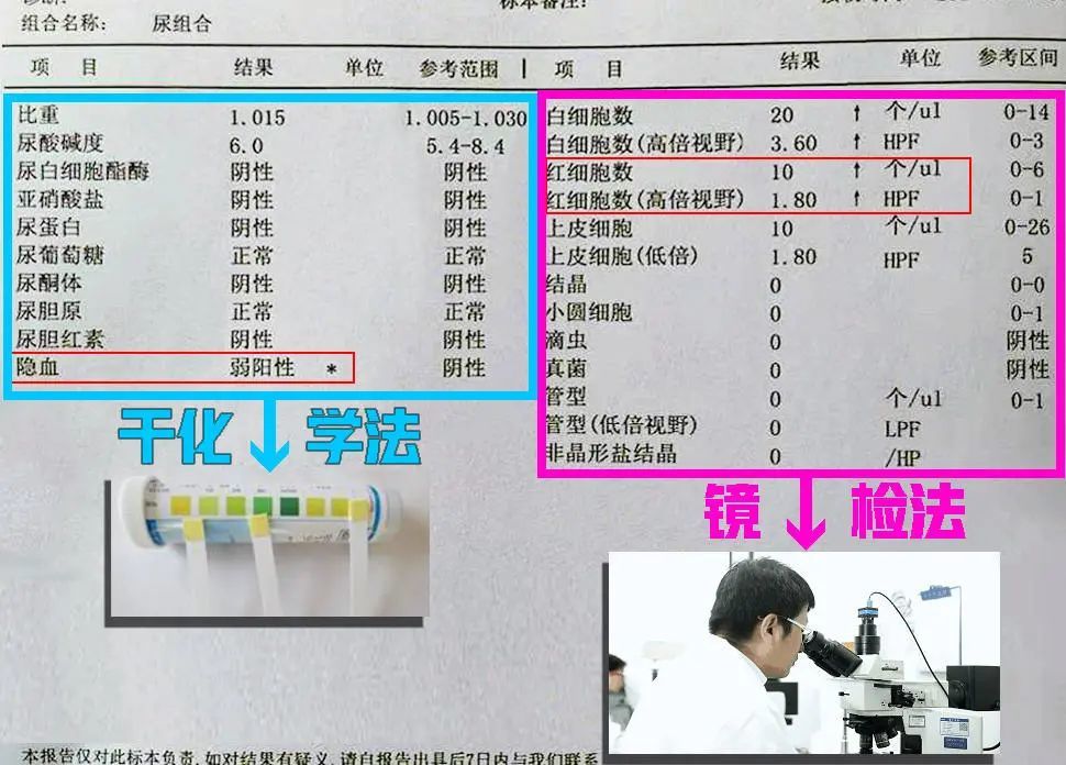 图中右侧的"红细胞数"指血红蛋白数量值得注意的是尿常规报告单上还有