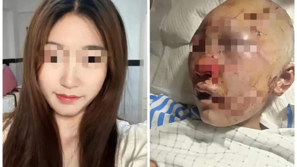 徐某事发前后照片对比 图片来自当事人社交帐号