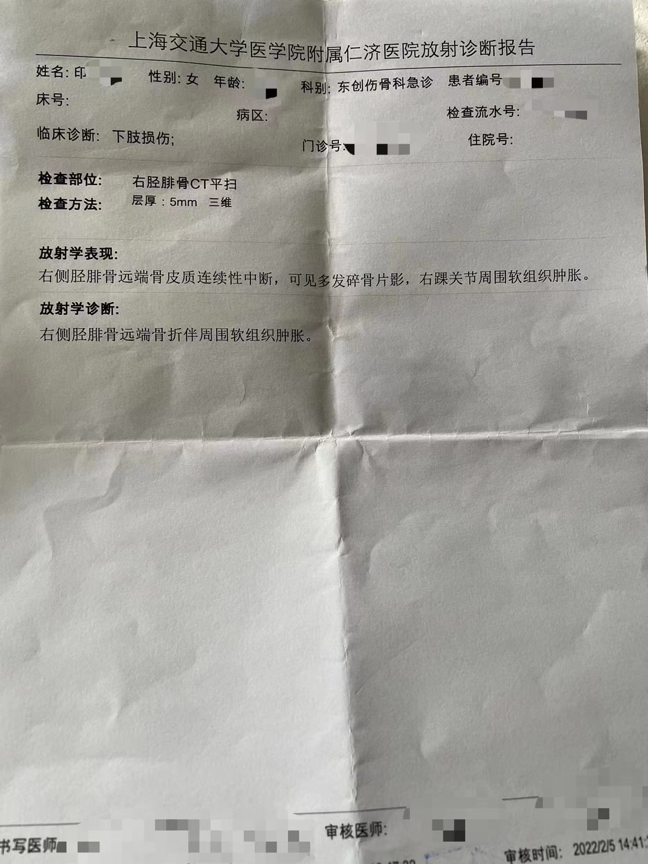 诊断,印女士的伤势为右脚三踝(内侧,外测及后侧)粉碎性骨折伴随韧带