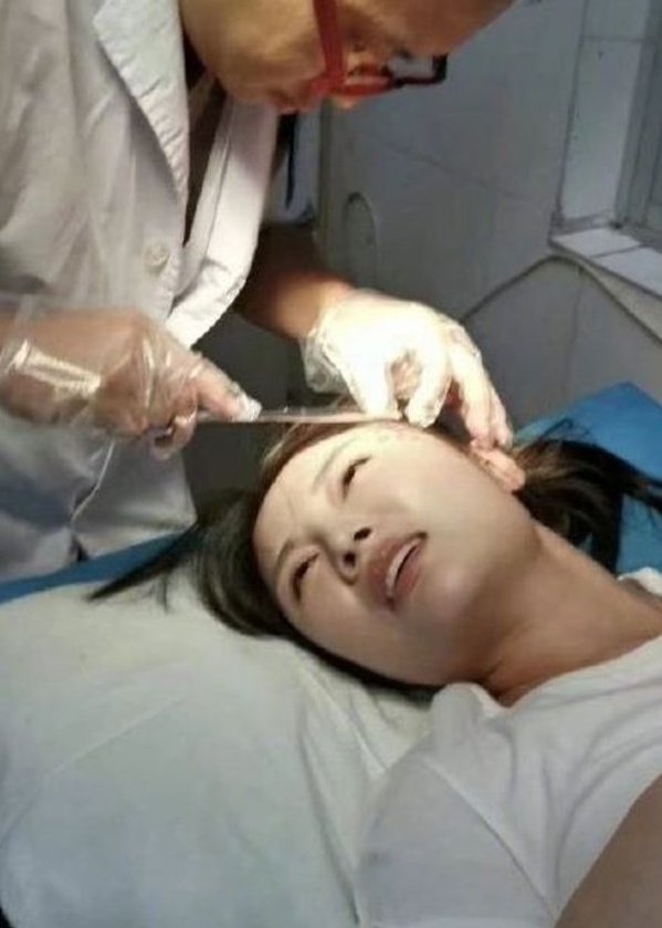 经纪人曝徐冬冬受伤险失明，前男友在同一剧组未陪同看伤