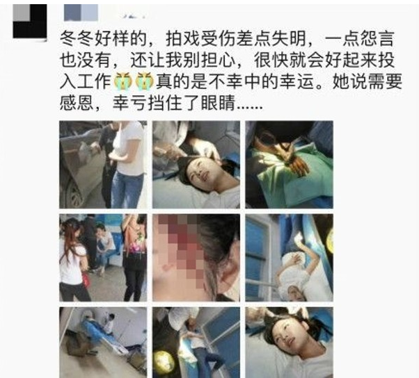 经纪人曝徐冬冬受伤险失明，前男友在同一剧组未陪同看伤