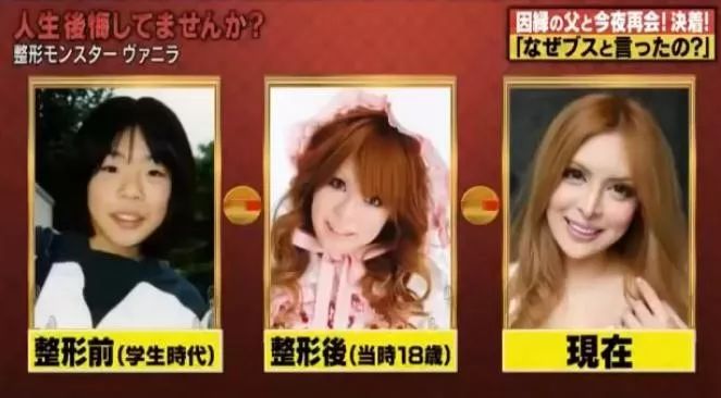 日本女星一心想成为法国洋娃娃，狂砸2亿日元整容超过100次...