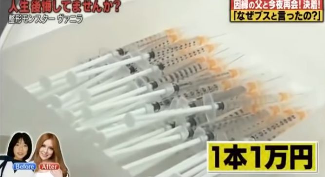 日本女星一心想成为法国洋娃娃，狂砸2亿日元整容超过100次...