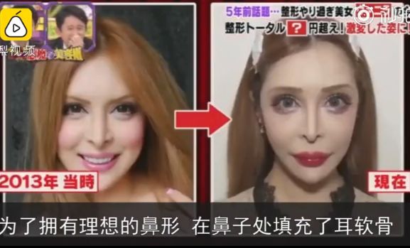 日本女星一心想成为法国洋娃娃，狂砸2亿日元整容超过100次...