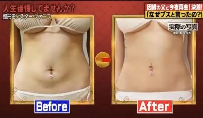 日本女星一心想成为法国洋娃娃，狂砸2亿日元整容超过100次...