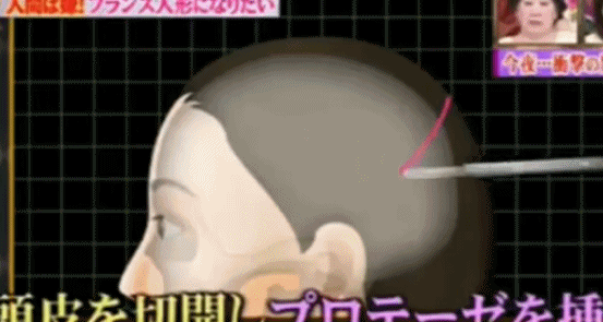 日本女星一心想成为法国洋娃娃，狂砸2亿日元整容超过100次...