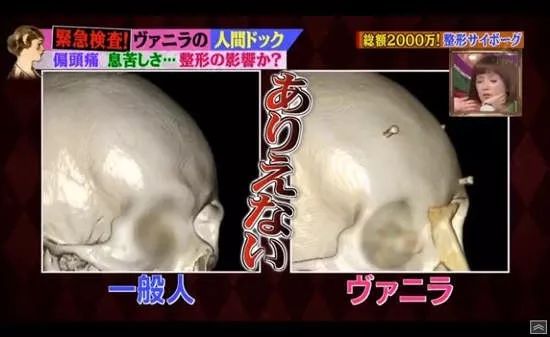 日本女星一心想成为法国洋娃娃，狂砸2亿日元整容超过100次...