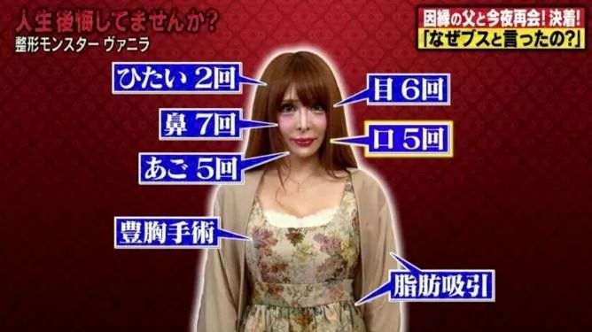 日本女星一心想成为法国洋娃娃，狂砸2亿日元整容超过100次...