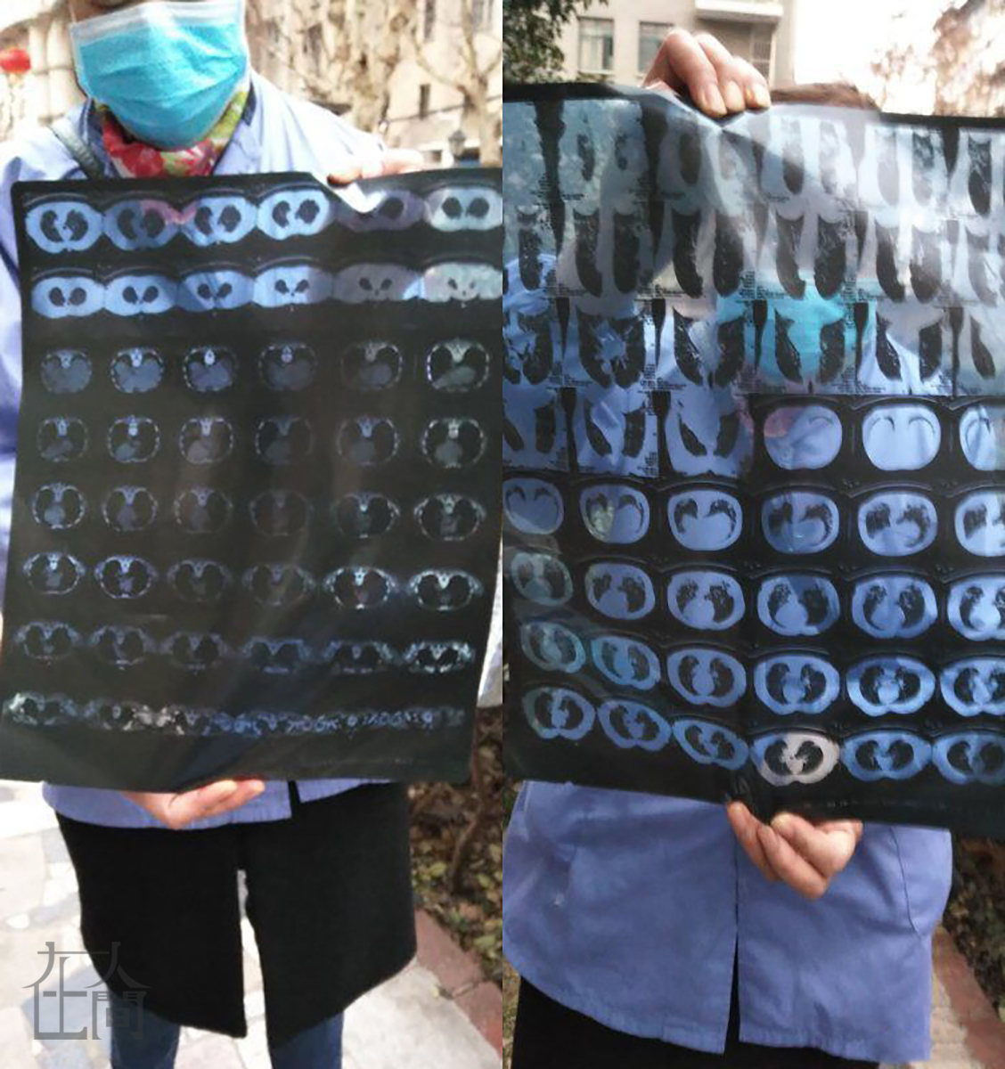 露宿街头的医院护工确诊了，这是个好的坏消息