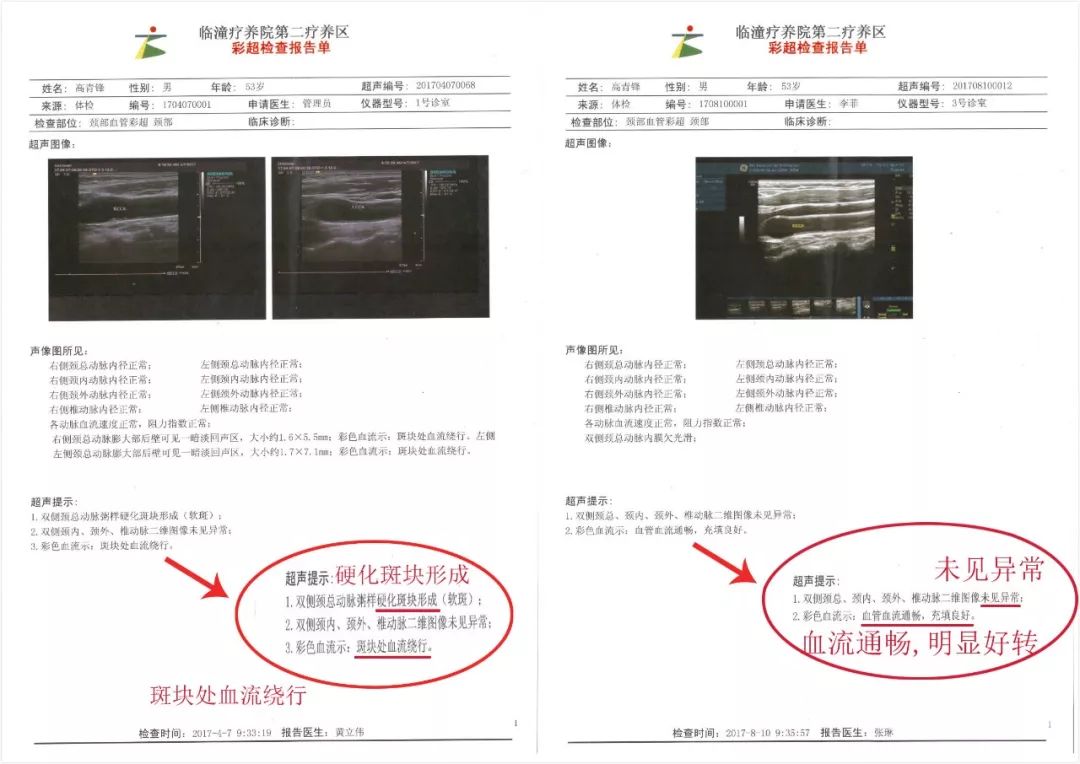 厂家大胆承诺, 凡有过血栓病史的人群, 凭3个月前后颈动脉彩超, 人体