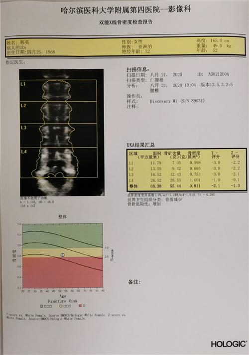 哈医大四院骨科为高龄压缩性骨折患者实施经皮球囊扩张椎体成型术