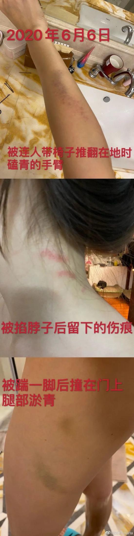 那个热搜上被“家暴”的女主角 我就知道这么多