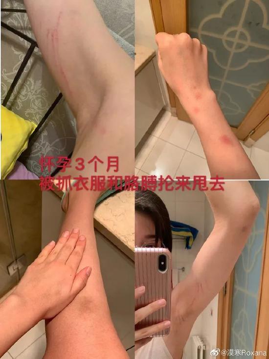 那个热搜上被“家暴”的女主角 我就知道这么多