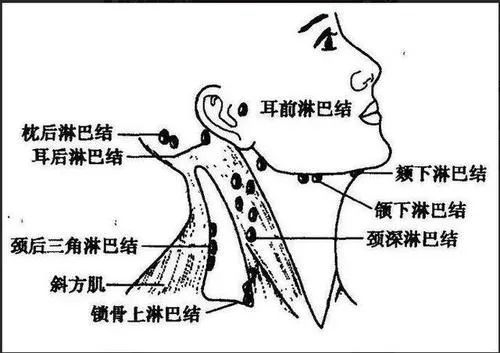 健康 健康快讯 正文 上图为颈部淋巴结分布情况 若淋巴结肿大时间较短